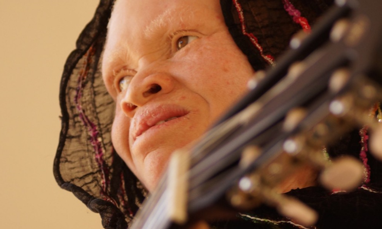 A member of the Tanzania Albinism Collective. Photo: Marilena Delli